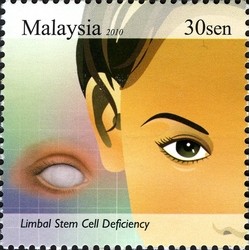 Colnect-614-151-Limbal-Stem-Cell-Deficiency.jpg