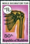 Colnect-4556-798-Rheumatic-shoulder.jpg