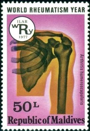 Colnect-4556-798-Rheumatic-shoulder.jpg