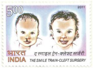 Colnect-956-420-Smile-Train---Cleft-Palate-Surgery.jpg