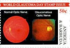 Colnect-5942-501-World-Glaucoma-Day.jpg