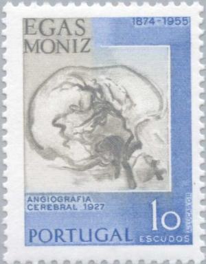 Colnect-173-124-Cerebral-angiograph-1927.jpg