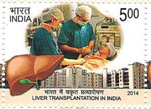 Colnect-2334-416-Liver-Transplantation-in-India.jpg