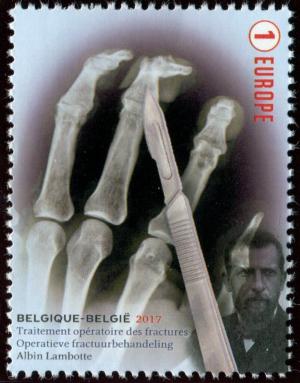 Colnect-5748-589-Albin-Lambotte-Operative-Fracture-Treatment.jpg