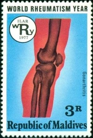 Colnect-4556-800-Rheumatic-knee.jpg